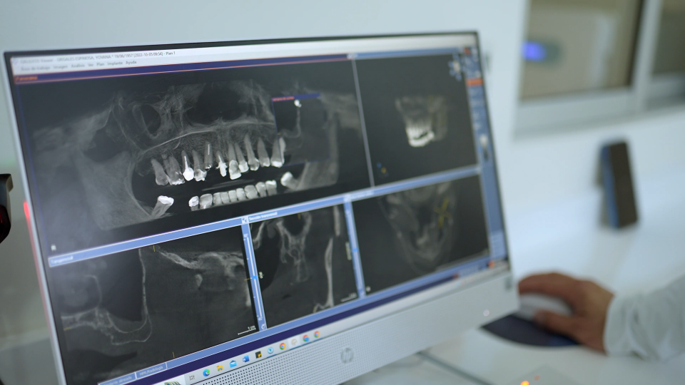 Radiologia oral